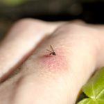 Mosquito Biting Finger