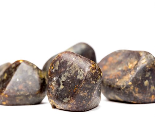 bladder stones