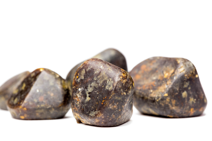 Bladder stones – causes, symptom...