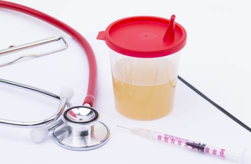 Blood in urine (hematuria) assoc...