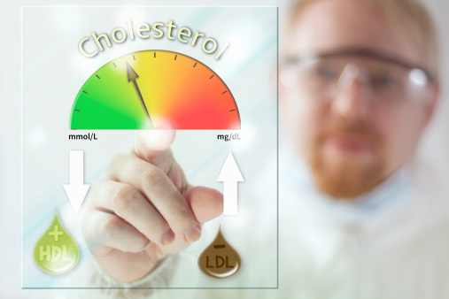 Cholesterol levels: Signs, sympt...