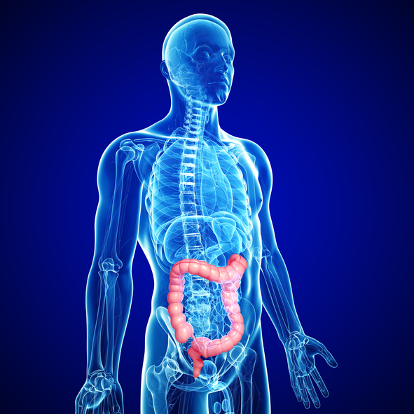 Diverticulitis complications: Re...