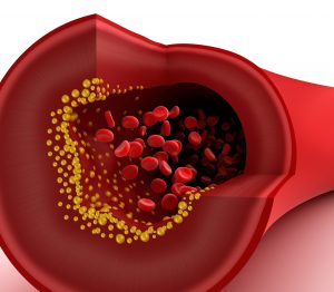 Intermediate HDL “good” cholesterol levels may increase longevity: Recent study