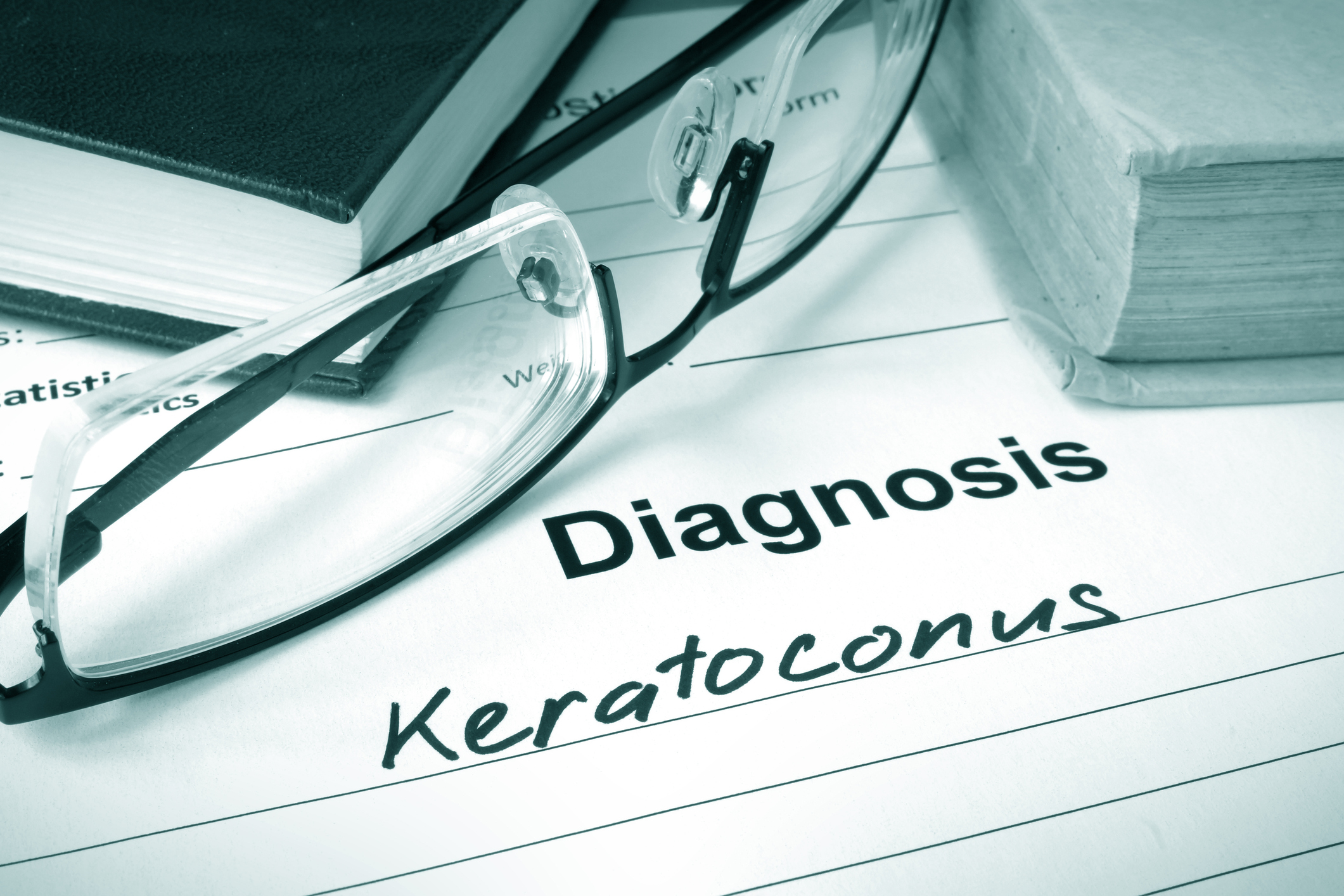 Keratoconus (corneal disease) tr...