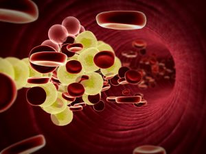 LDL cholesterol variability associated with declining cognitive performance in older adults: Study