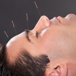 Mild cognitive impairment slowed with acupuncture: Study