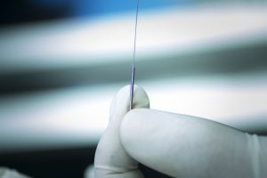 Acupuncture needle dry needling