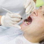 periodontitis-gum-disease-in-psoriasis