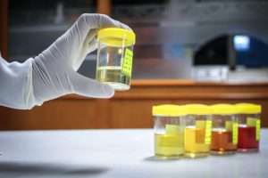 Pyuria (pus in urine) causes and treatments