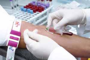 Stroke risk may be predicted with a blood test