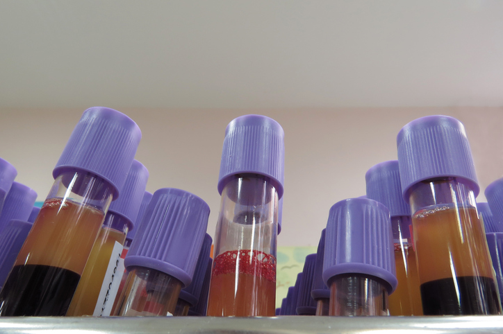 Triglyceride levels in postmenop...