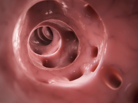 Ulcerative colitis update 2016: ...