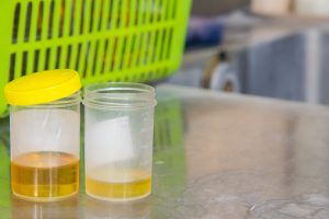Zika virus outbreak 2016: Faster urine test and portable saliva test to detect Zika virus