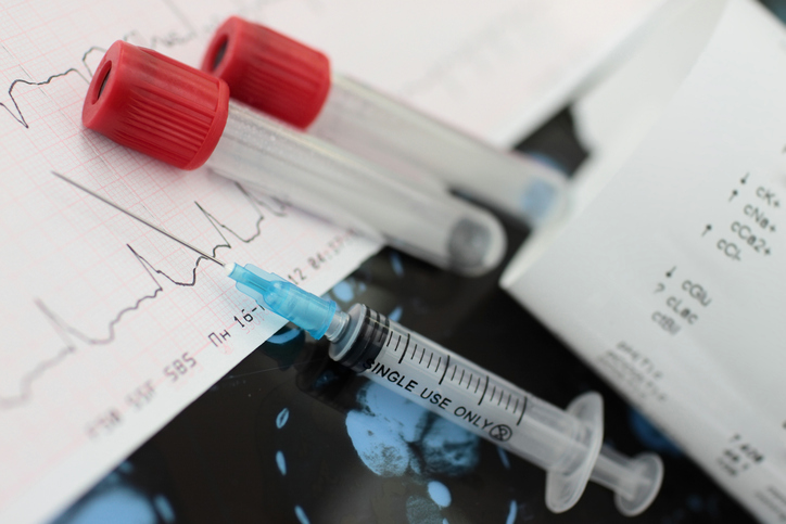 Atrial fibrillation in elderly l...