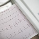 atrial-fibrillation-irregular-heartbeat-risk