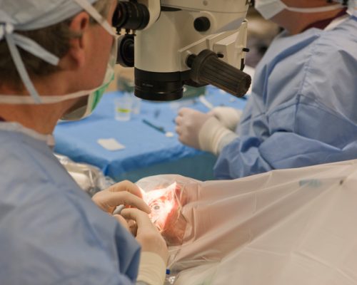 cataract surgery to correct visual impairment