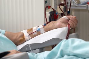 CDC focuses on improving safety during dialysis