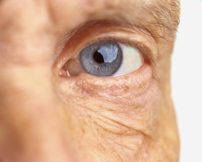 Eye exercises for presbyopia (fa...