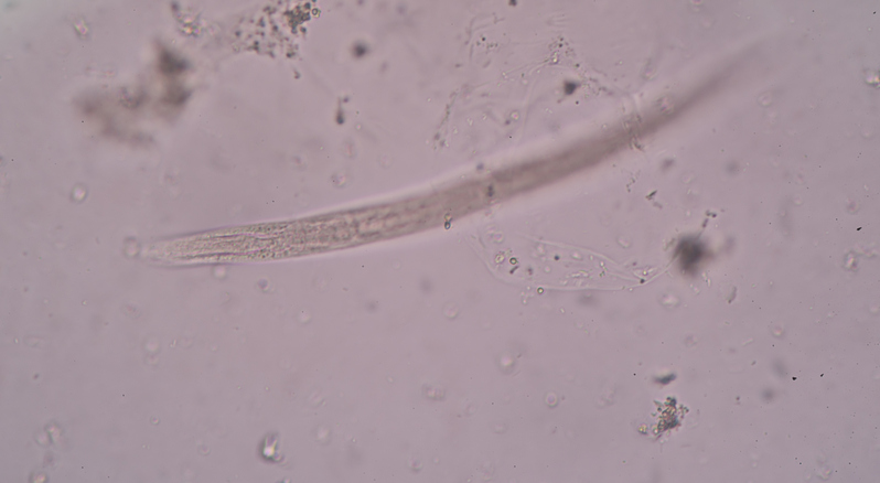 Inflammatory bowel disease treat...