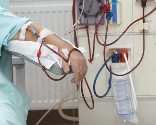 dialysis kidney patients