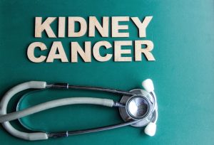 Low cholesterol may increase mortality risk in kidney cancer patients: Study 