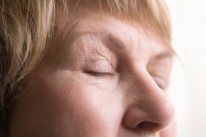 Meibomian gland dysfunction causing dry eye syndrome