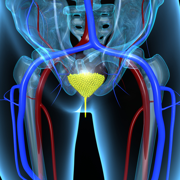 Neurogenic bladder in elderly: C...