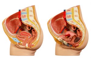 pelvic organ prolapse risk increases with high bmi after pregnancy