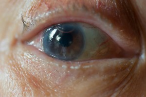 Home Eye Safety Month: Cataracts...