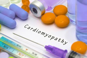 restrictive cardiomyopathy may lead to heart failure after diagnosis