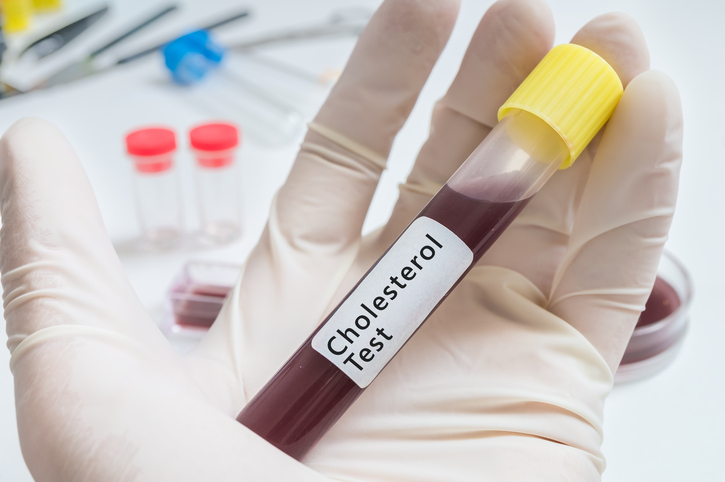 Why ‘good’ cholesterol may actua...