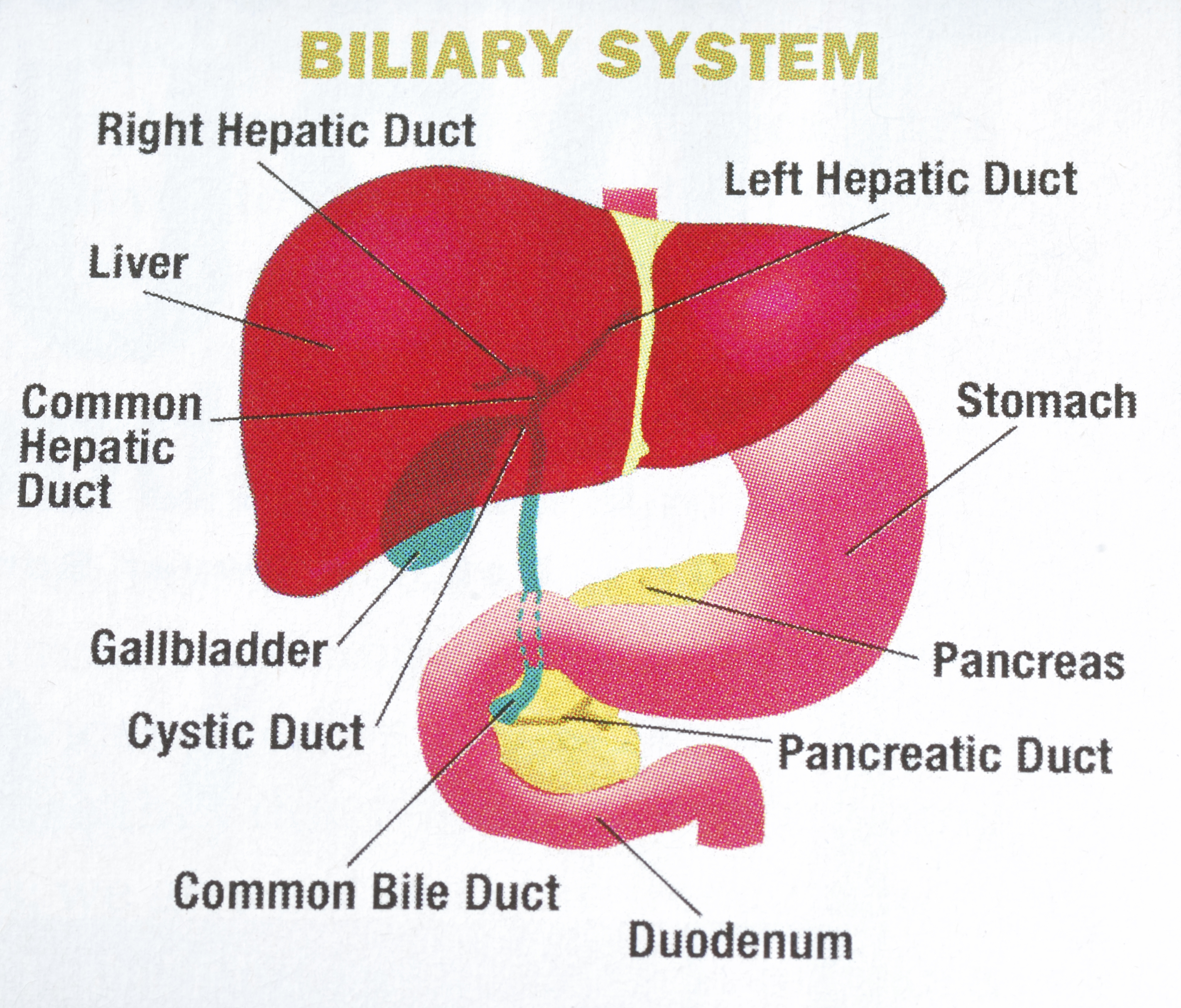 Bad acid reflux after gallbladder removal