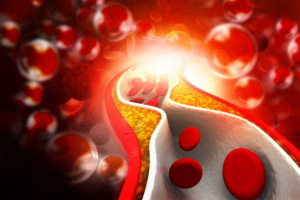 The side effect of cholesterol you don’t know about