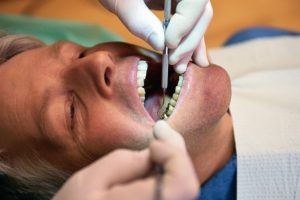 Dental cleaning doesn’t just improve oral health, boosts lung health, too