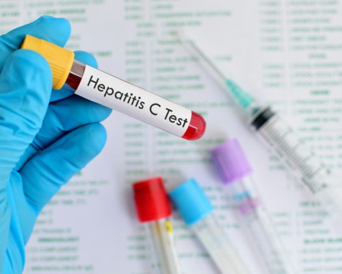 hepatitis c testing recommended for baby boomers