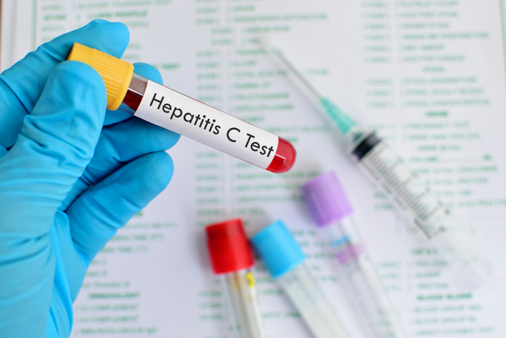 Hepatitis C screening recommende...