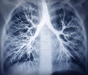 Healthy Lung Month: Asthma, bron...