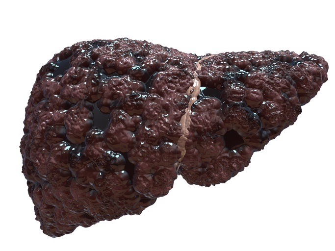 Non-alcoholic fatty liver diseas...