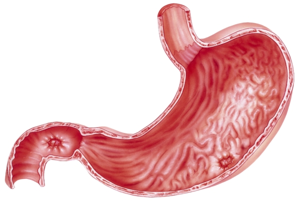 Peptic ulcer symptoms: Tips to r...