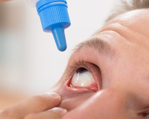 Schirmer’s test for dry eye syndrome: Preparation, procedure, and results