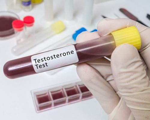 testosterone may be linked to hardenng of arteries associated with heart disease