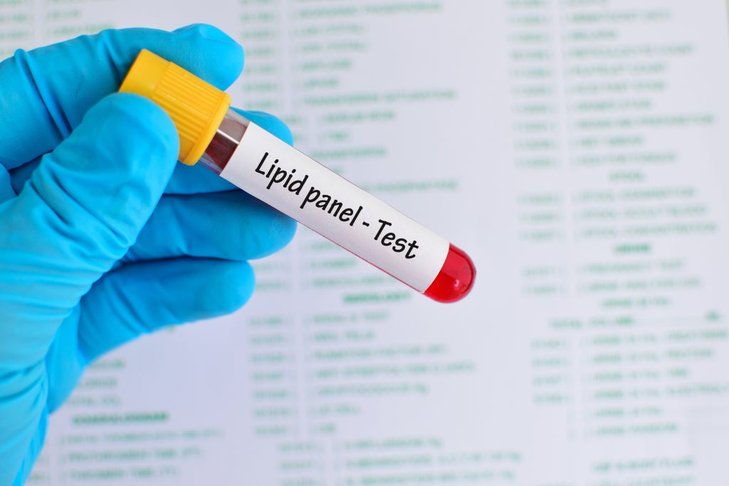 VLDL cholesterol Tests, function, and home remedies