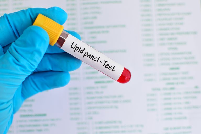 VLDL cholesterol Tests, function, and home remedies