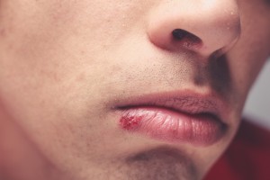 National Healthy Skin Month 2016...