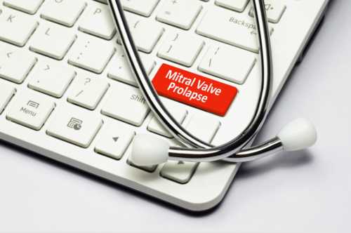 Mitral valve prolapse: Causes, s...