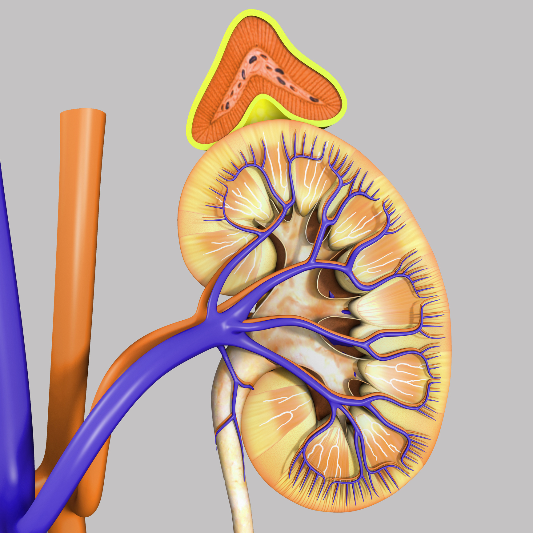 Primary aldosteronism: Causes, s...
