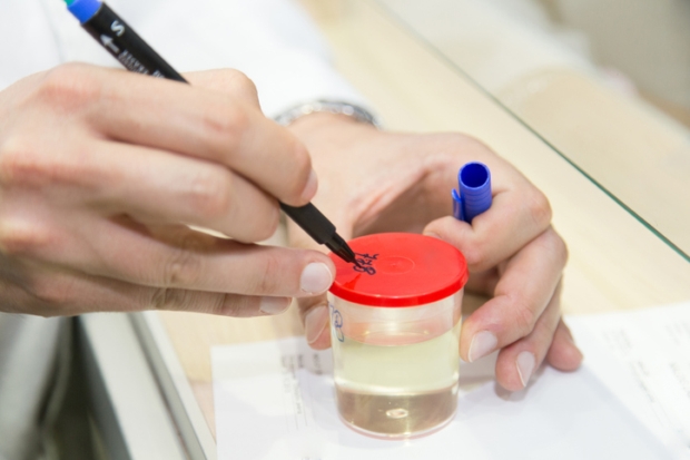 Bubbles in urine: Causes, sympto...