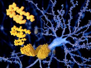 Alzheimer’s disease treatment and prevention opportunity recently discovered: Study