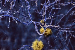 Weekly health news roundup: Alzh...