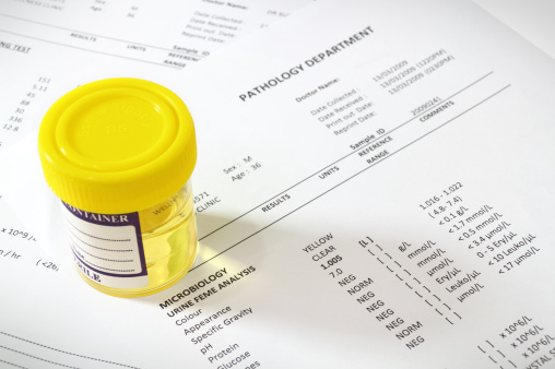 Memory problems, dementia risk i...